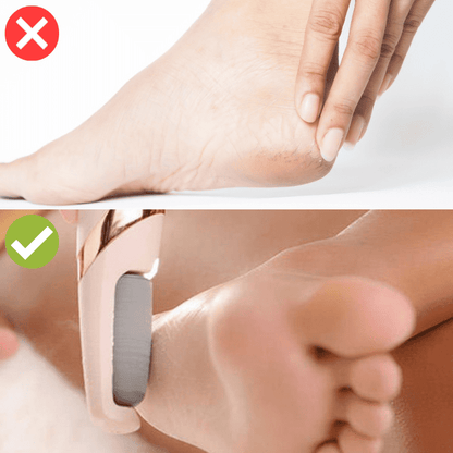 Lixa Elétrica Removedora de Calos e Rachaduras - Soft Skin + Pente de lixa grossa de brinde